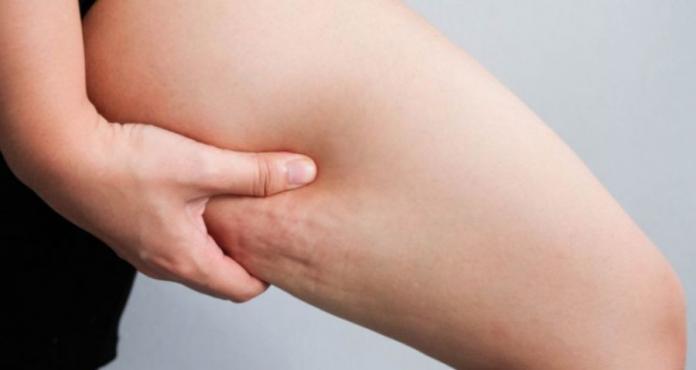 Mercadona: nuevo concentrado contra la celulitis de Deliplus