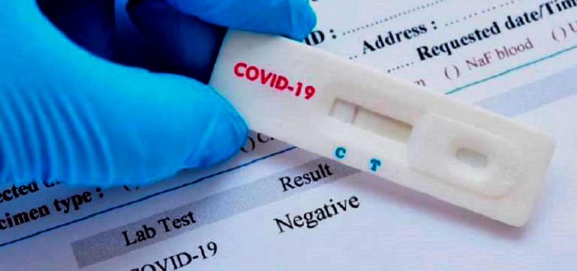 Actualidad de Lidl y Aldi:venta de test rápidos para detectar al coronavirus