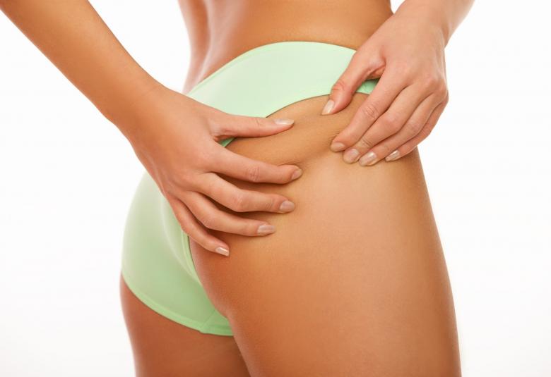 Mujer mostrando los resultados de productos anticeluliticos